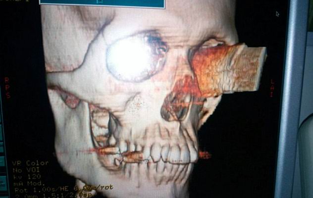 �������� ������� �������� - ���������� �� ������� �����