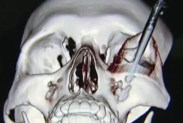 �������� ������� �������� - ���������� �� ������� �����