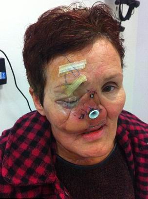 ������ ���������� - ���������� �� ������� �����