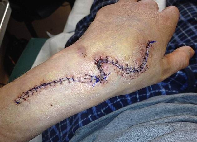 ����� ������ - ���������� �� ������� �����