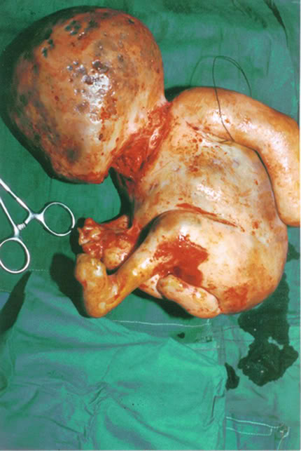 ���� �������� - ���������� �� ������� �����