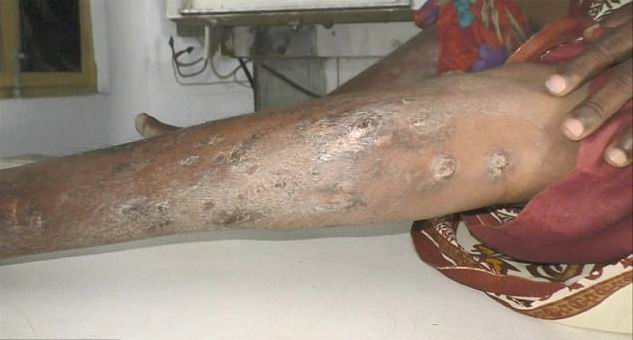 ������� ���� - ���������� �� ������� �����