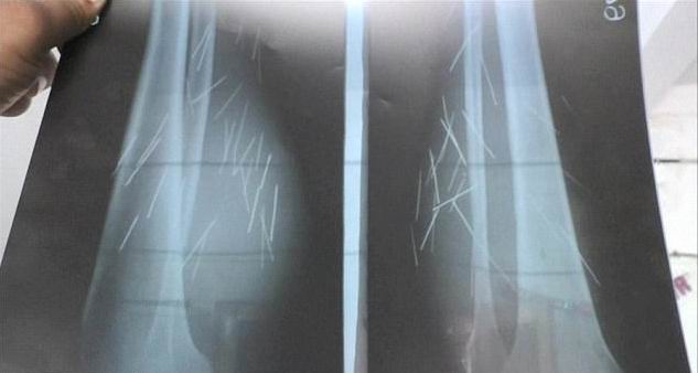 ������� ���� - ���������� �� ������� �����