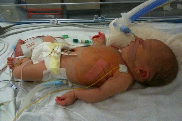 ���� ����