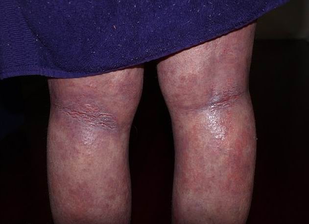 ���� ����� - ���������� �� ������� �����